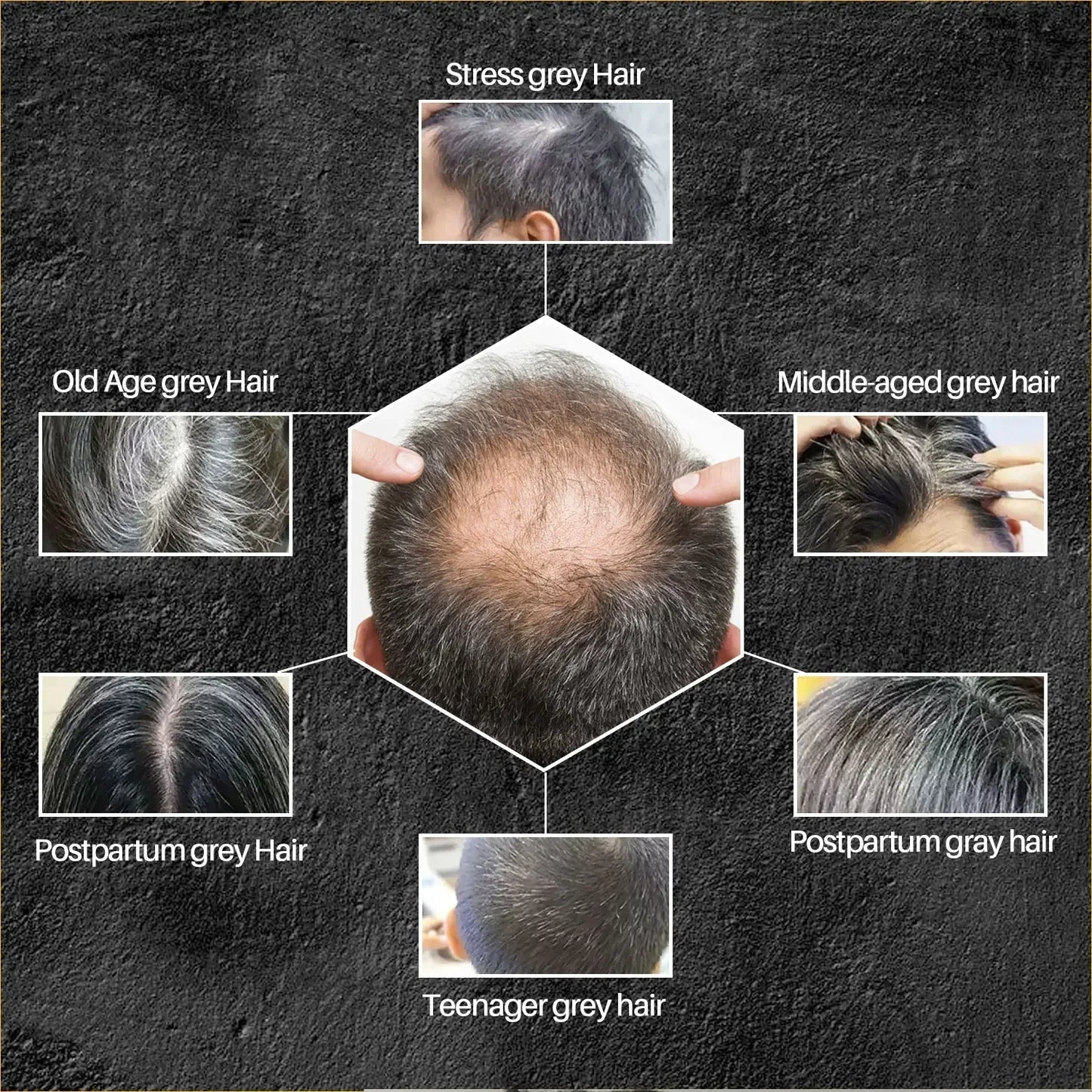 Hair Shampoo Soap Bar Cover Gray Hair Polygonum Multiflorum Dye Canas Hair Dye Shampoo Black Soap White Hair to Black Soap Cover