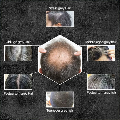 Hair Shampoo Soap Bar Cover Gray Hair Polygonum Multiflorum Dye Canas Hair Dye Shampoo Black Soap White Hair to Black Soap Cover